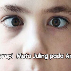 Terapi Mata Juling